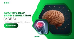 Adaptive Deep Brain Stimulation
