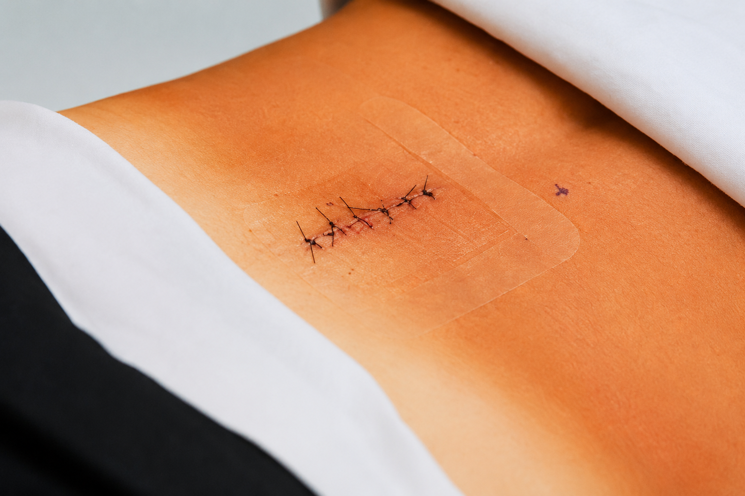 Lumbar spine surgery in Gurgaon by Dr. Vikas Kathuria
