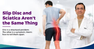 Slip Disc vs Sciatica: Understanding the Difference