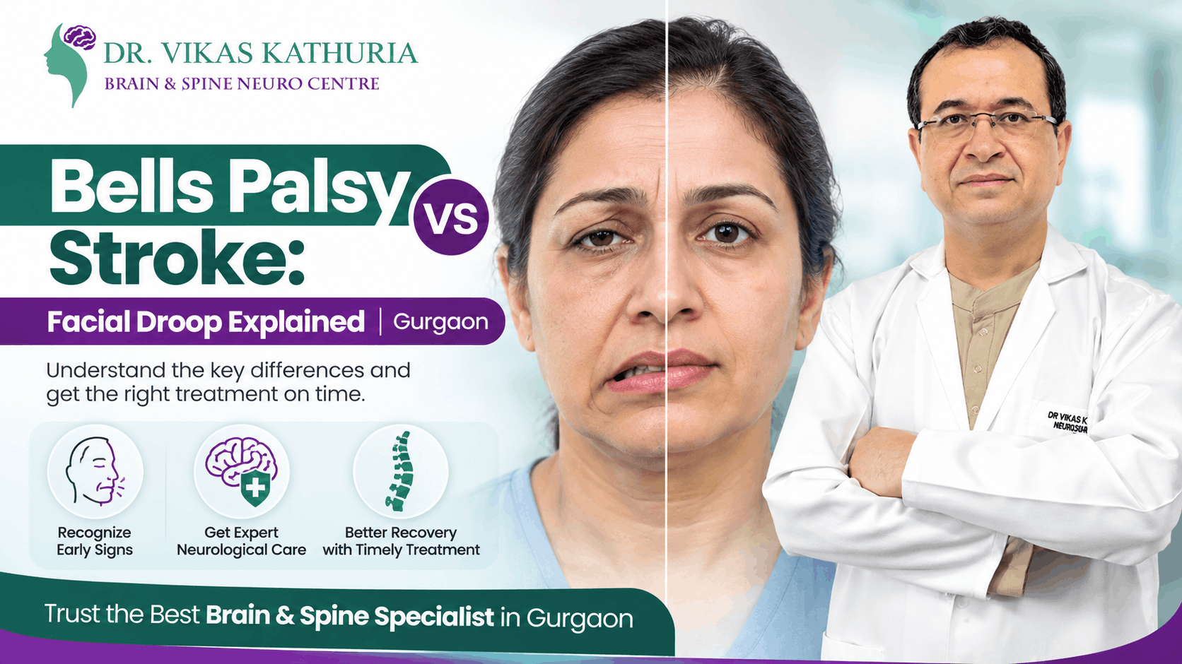 Bells Palsy vs Stroke: Facial Droop Explained | Gurgaon